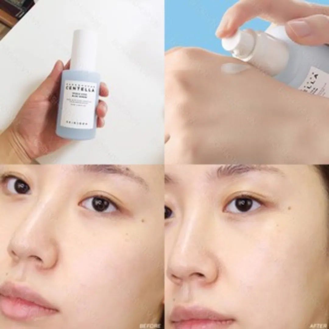 Skin1004 Madagascar Centella Hyalu-Cica Blue Serum - 30ml