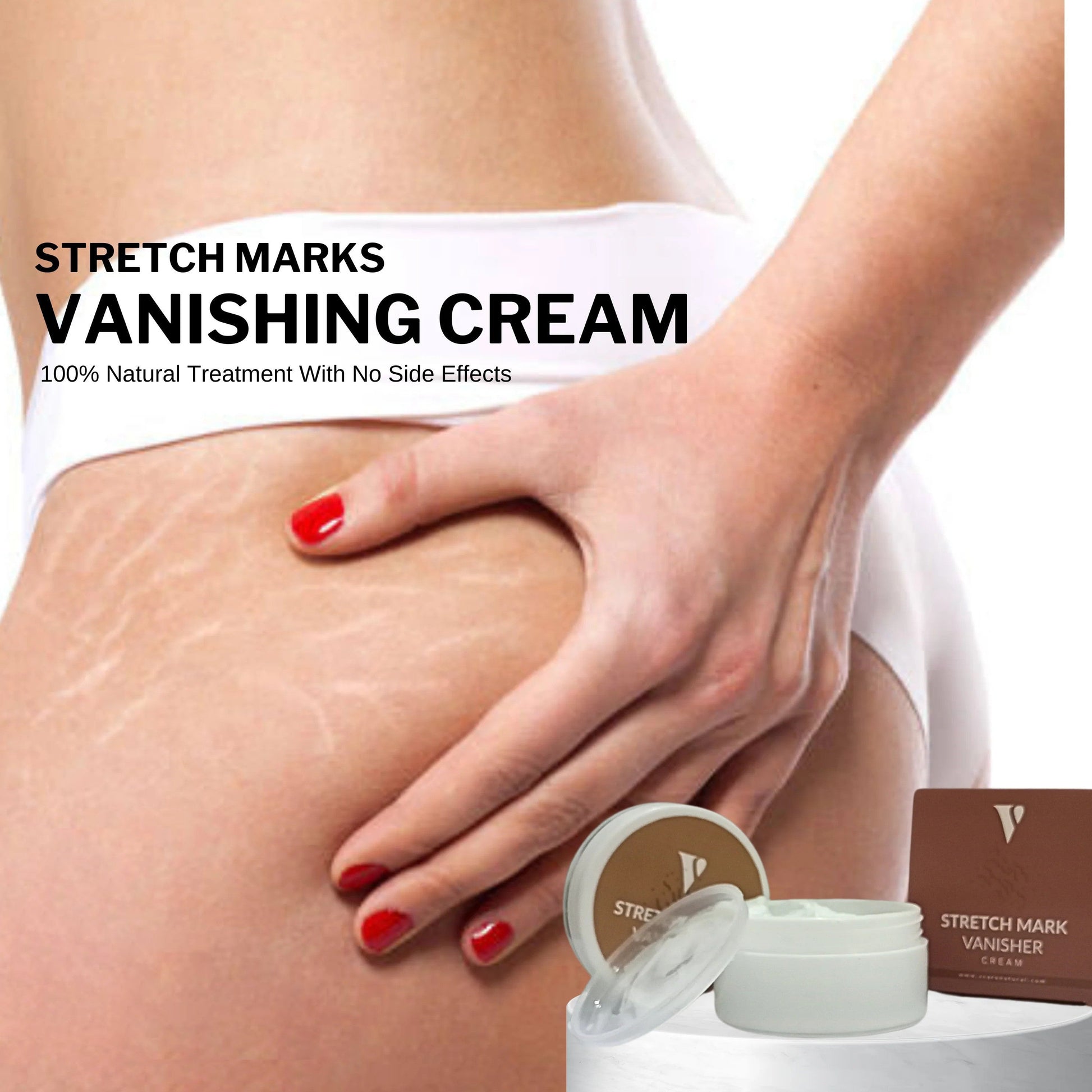 Stretch Mark Vanishing Cream Vcare Natural www.vcarenatural.com