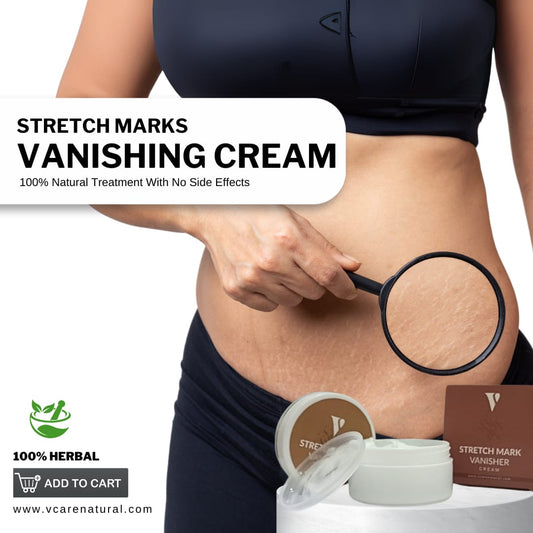 Stretch Mark Vanishing Cream Vcare Natural www.vcarenatural.com